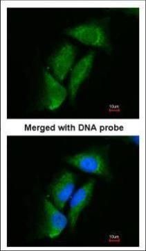 DPP3 Rabbit Polyclonal Antibody