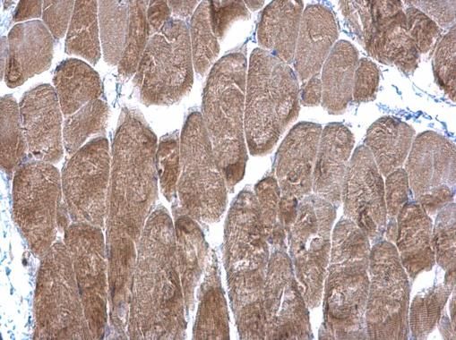 DPP3 Rabbit Polyclonal Antibody