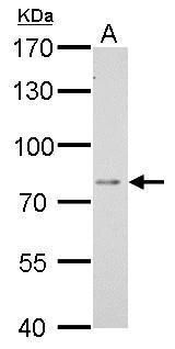 DPP3 Rabbit Polyclonal Antibody
