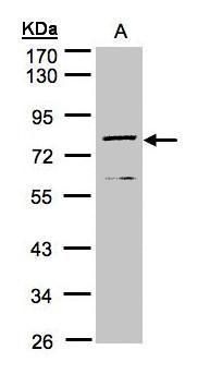 DPP3 Rabbit Polyclonal Antibody