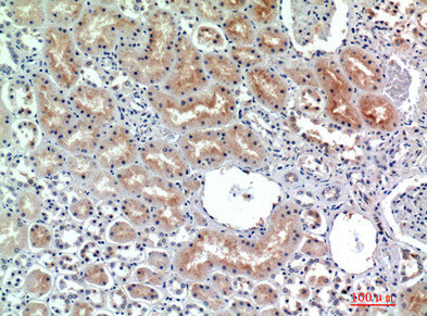 DPP4 Antibody