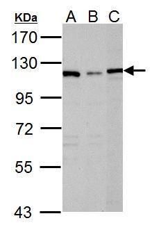 DPYD Rabbit Polyclonal Antibody
