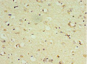 DRD3 Antibody