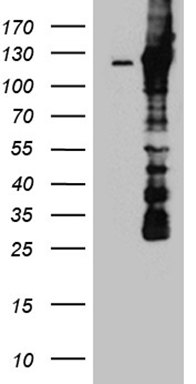 Drebrin Antibody