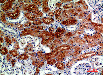 DROSHA Antibody