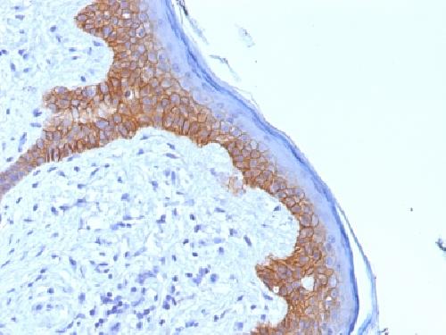 DSG3 Antibody