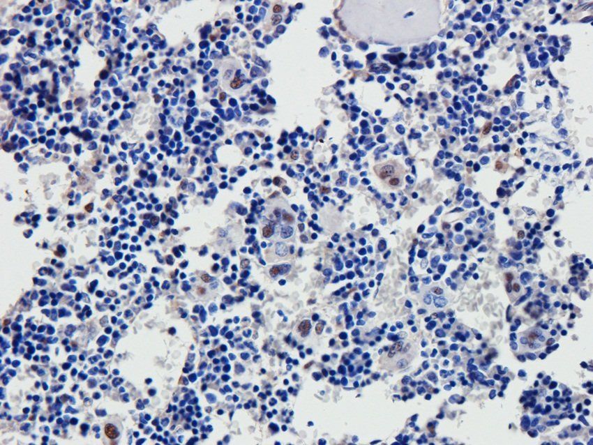 DSPP Rabbit Polyclonal Antibody