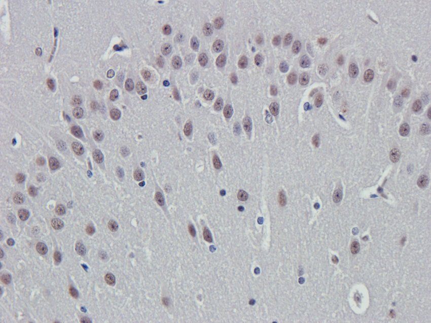 DSPP Rabbit Polyclonal Antibody