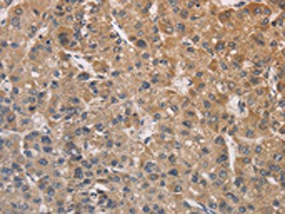 DSTN Antibody