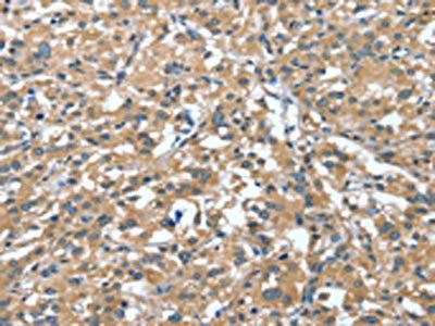 DTX1 Antibody