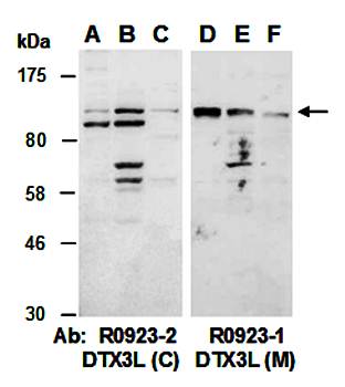 DTX3L (C) Antibody, Rabbit Polyclonal