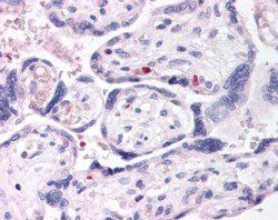 DUSP16 Antibody
