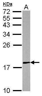 dual specificity phosphatase 26 Antibody