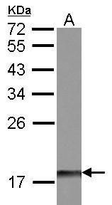 dual specificity phosphatase 26 Antibody