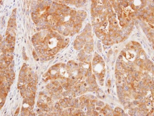 DUSP3 Rabbit Polyclonal Antibody