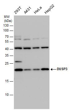 DUSP3 Rabbit Polyclonal Antibody