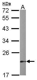 DUSP3 Rabbit Polyclonal Antibody