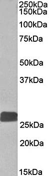 DUSP6/MKP3 Antibody