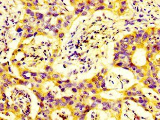 DUSP9 Antibody
