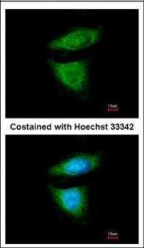 dynein cytoplasmic 1 intermediate chain 2 Antibody