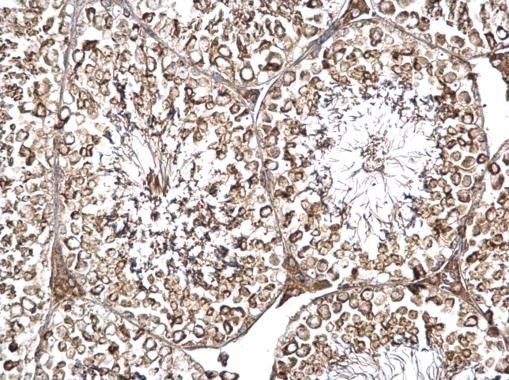dynein cytoplasmic 1 intermediate chain 2 Antibody
