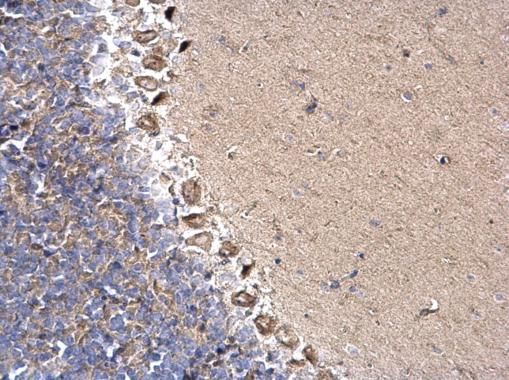dynein cytoplasmic 1 intermediate chain 2 Antibody