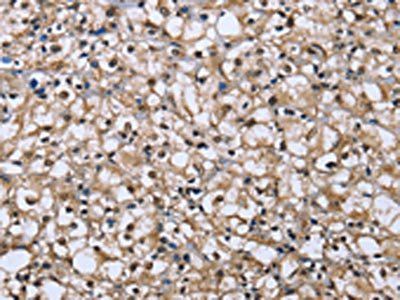 DYNLL1 Antibody