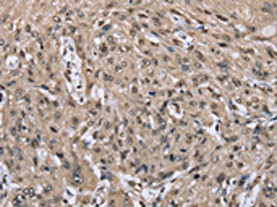 DYNLL1 Antibody