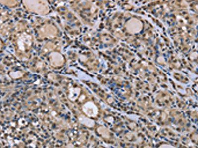 DYNLL1 Antibody