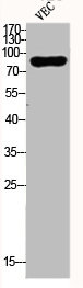 DYRK1A Antibody
