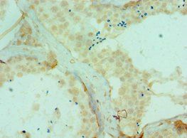 DYRK2 Antibody