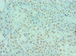 DYRK2 Antibody