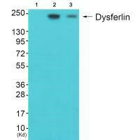 DYSF Antibody