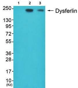 Dysferlin Antibody