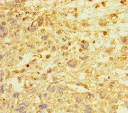E2F1 Antibody