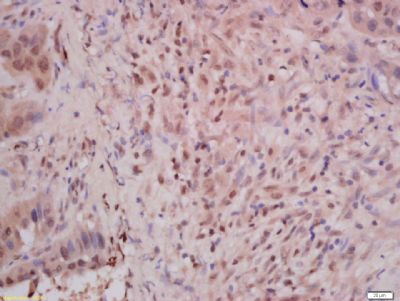 Phospho-E Cadherin (Ser838 + Ser840) Rabbit Polyclonal Antibody