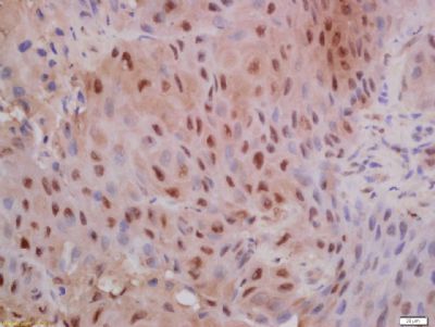 Phospho-E Cadherin (Ser838 + Ser840) Rabbit Polyclonal Antibody