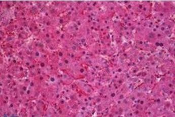 SEC61A1 Antibody