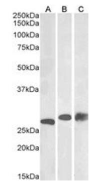 PGAM1/PGAM2/PGAM4 Antibody