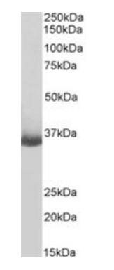 Goat anti-CD20 / MS4A1 (C Terminus), biotinylated Antibody