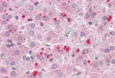 SET/I2 alpha PP2A Antibody