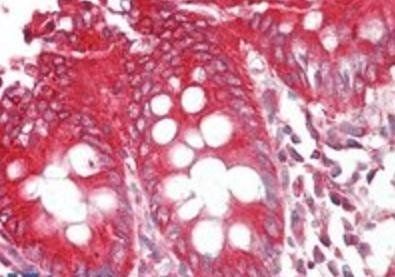 BIF-1/SH3GLB1 Antibody