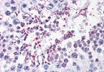 DUSP14/MKP6 Antibody