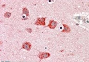 Goat anti-DKK3 / REIC Antibody