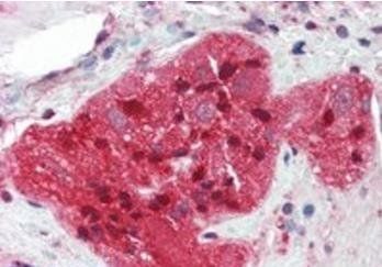 STMN2/SCG10 Antibody