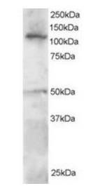 SMARCA3 Antibody