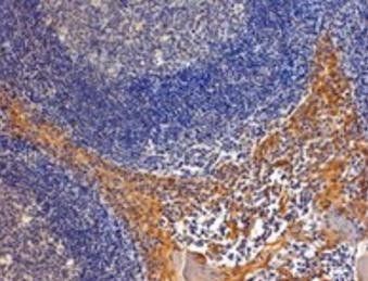 RANBP8/IPO8 Antibody