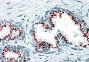 Goat anti-GOLPH2 Antibody