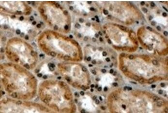 RNF34/RFI (N Terminus) Antibody