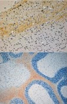 JIP3/Syd2/JSAP1 Antibody